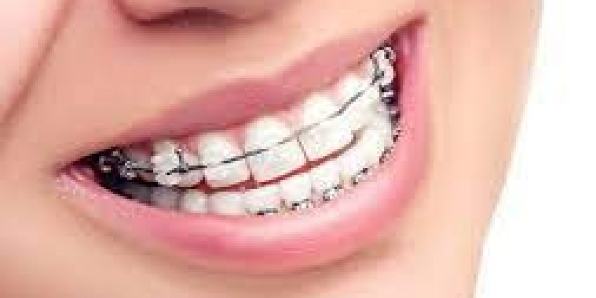The Top Dental Devices in Riyadh to Elevate Your Smile