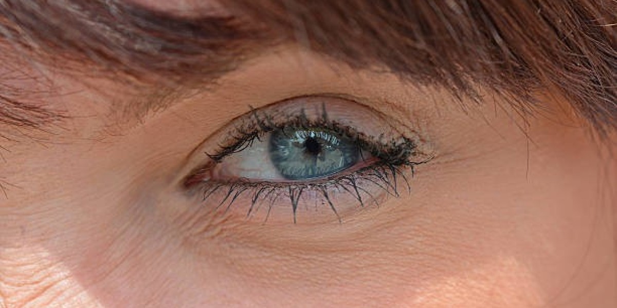 Say Farewell to Tired Eyes: Eye Bag Removal in Riyadh