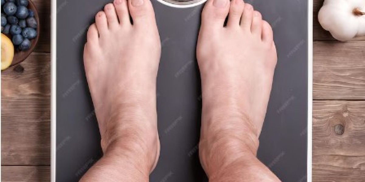 The Impact of Obesity on Mental Health: A Closer Look