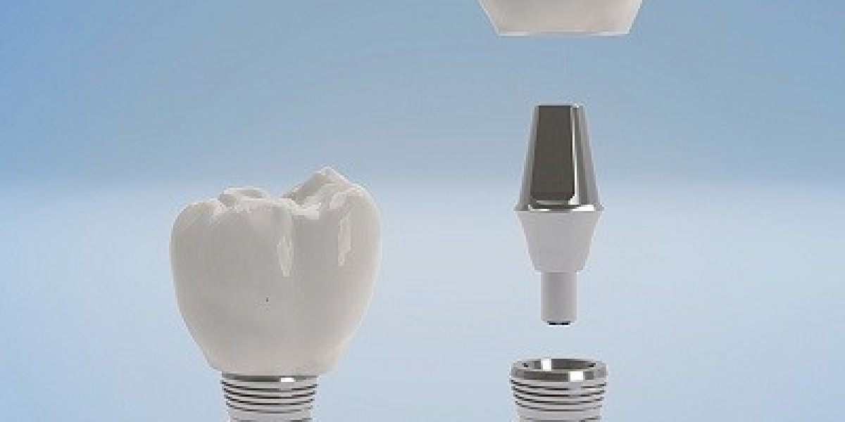 What Makes Dubai a Leading Destination for Dental Implants?