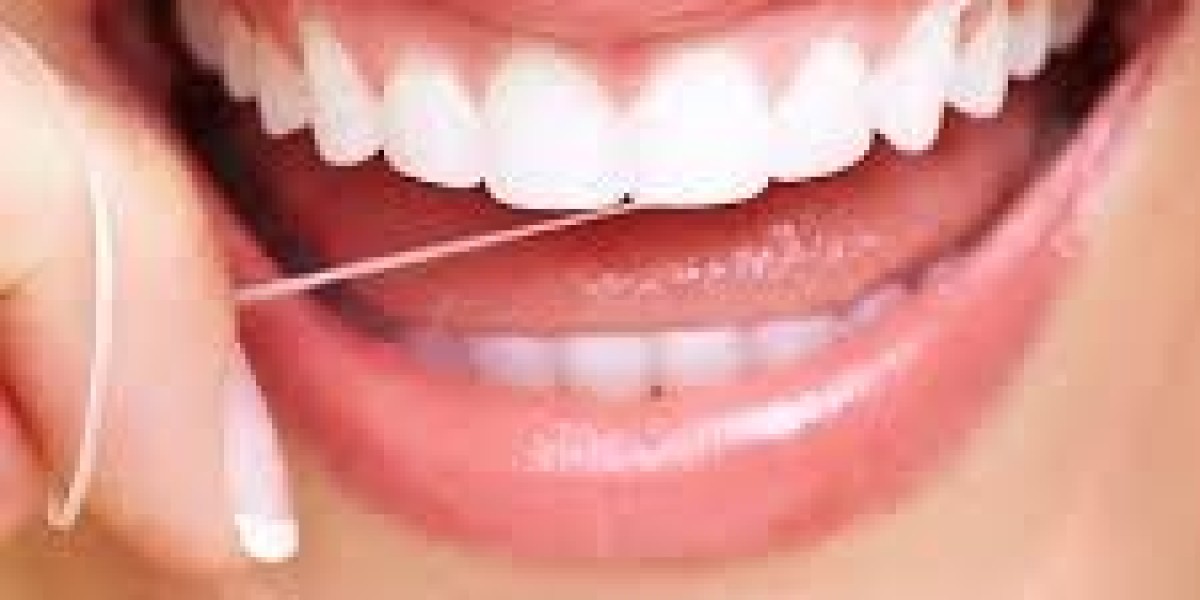 What Influences Tooth Filling Cost in Dubai