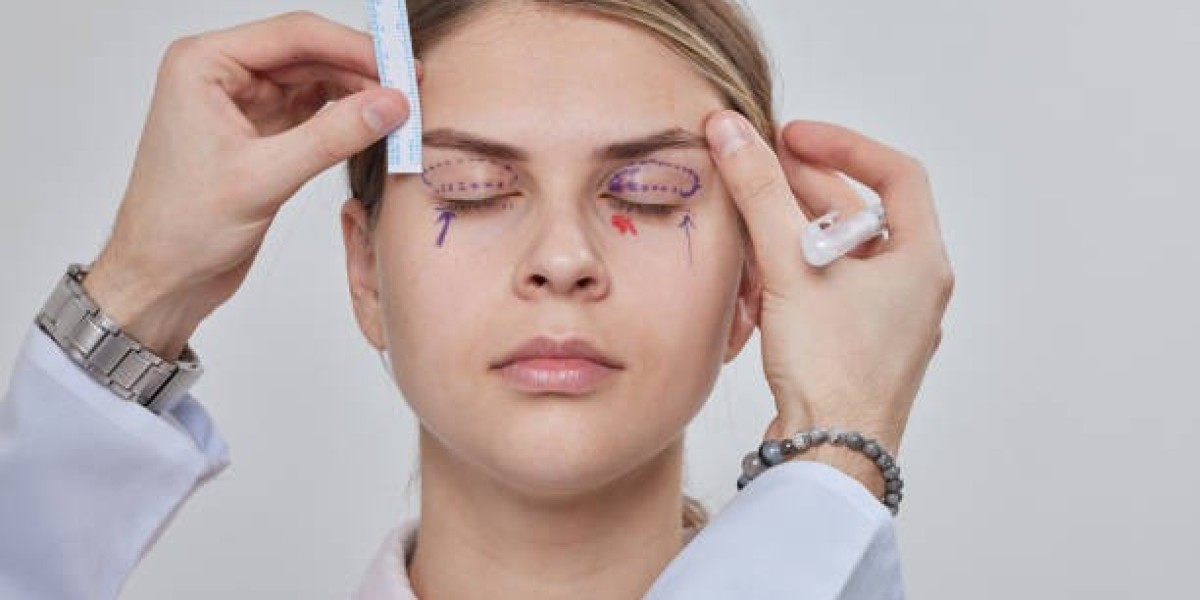 Best Eyelid Surgery in Riyadh: Get the Perfect Eye Lift