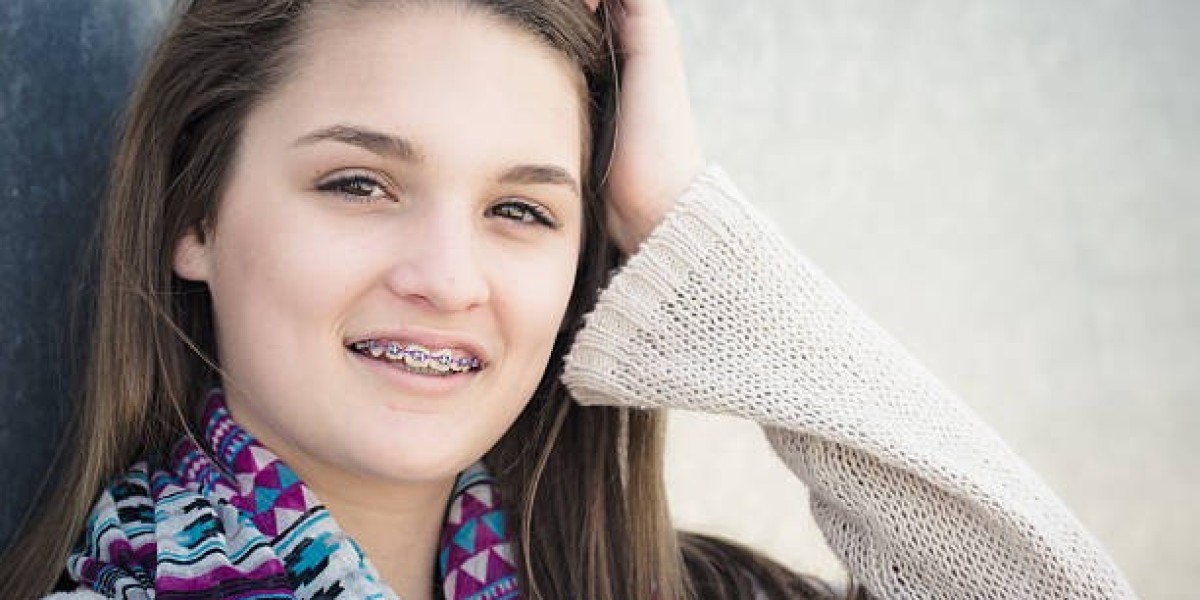 Orthodontic Success with Metal Braces in Riyadh: What You Need to Know