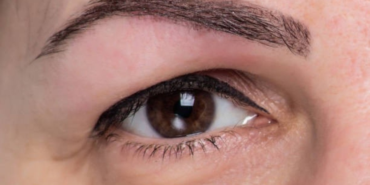Say Goodbye to Tired Eyes: Eye Bag Removal Options in Riyadh