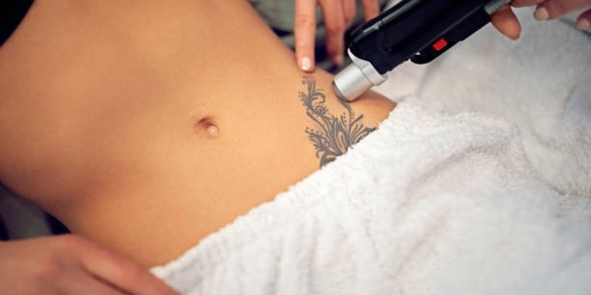 Get Rid of Tattoos Fast: Riyadh's Laser Removal Experts
