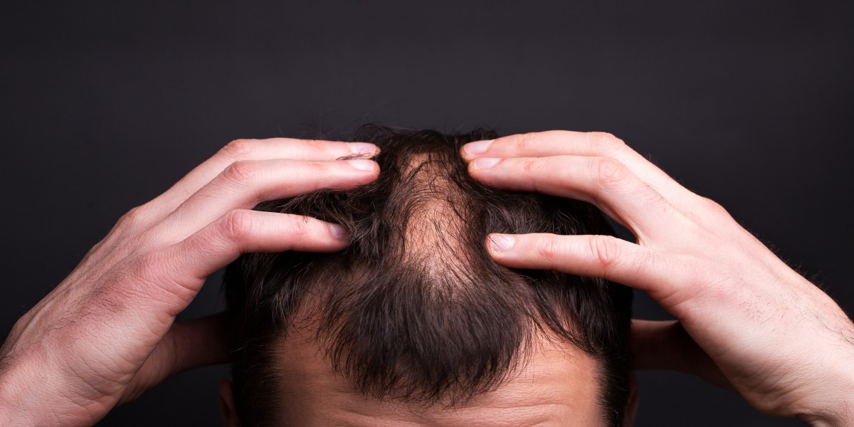 What is the cycle of hair loss?