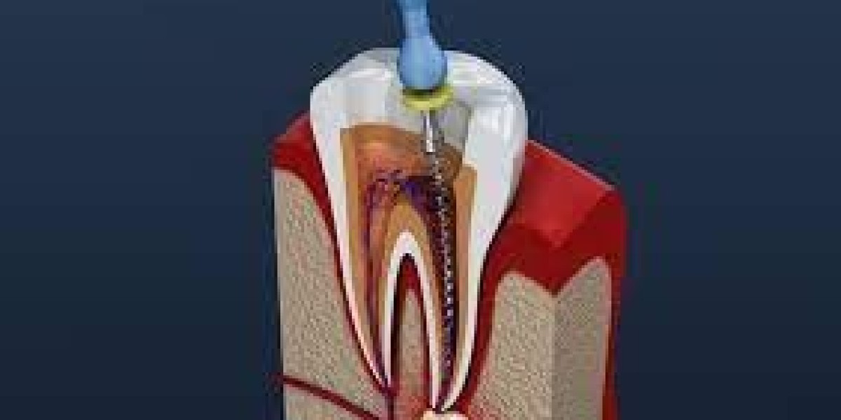What to Expect from the Best Dental Clinic in Dubai for Dental Exams