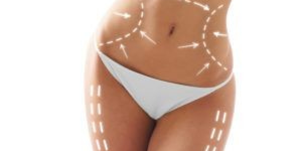How Often Should You Have CoolSculpting in Dubai?