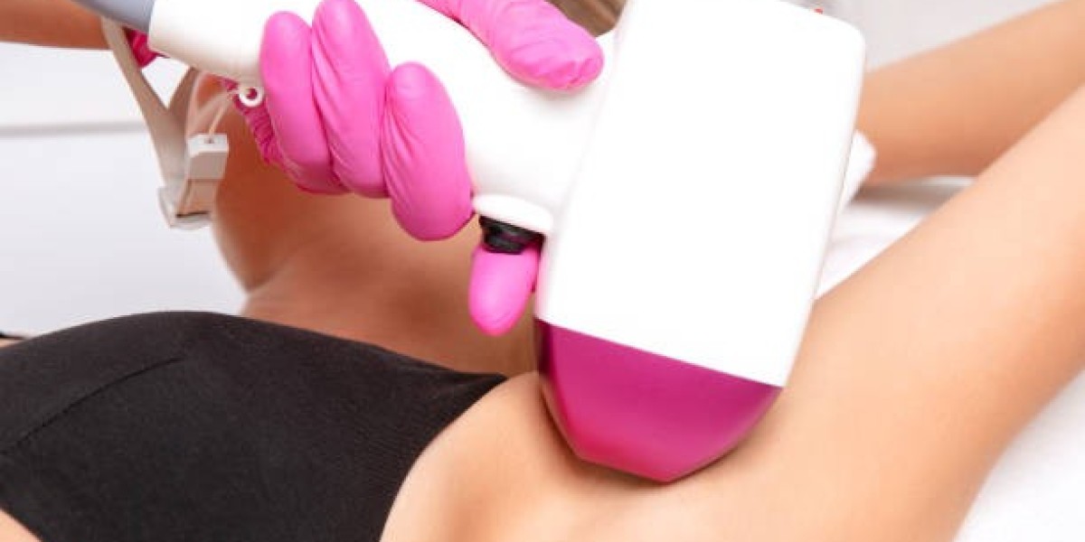 Your Laser Hair Removal Journey Starts Here: Riyadh’s Best Spots