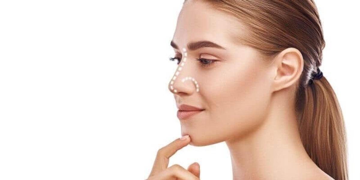 Enhancing Your Profile: The Benefits of Closed Rhinoplasty