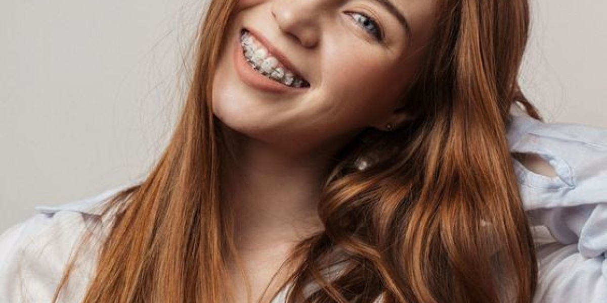 The Benefits of Metal Braces for Riyadh Residents