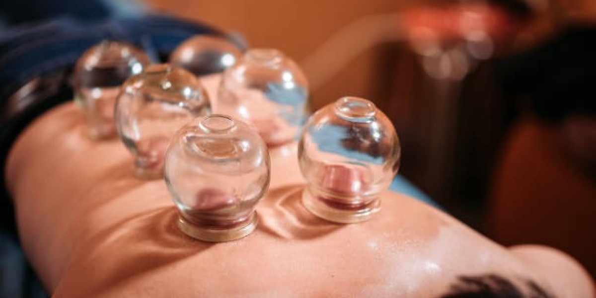 Cupping Treatment in Riyadh: Your Wellness Solution