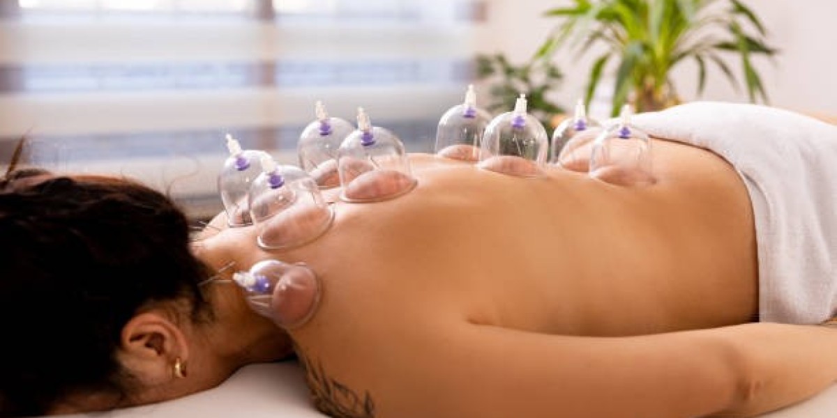 How Cupping Treatment in Riyadh Can Enhance Your Life