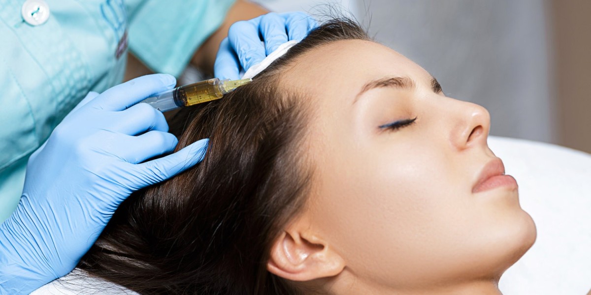 How Long Do PRP Hair Treatment Results Last in Riyadh?