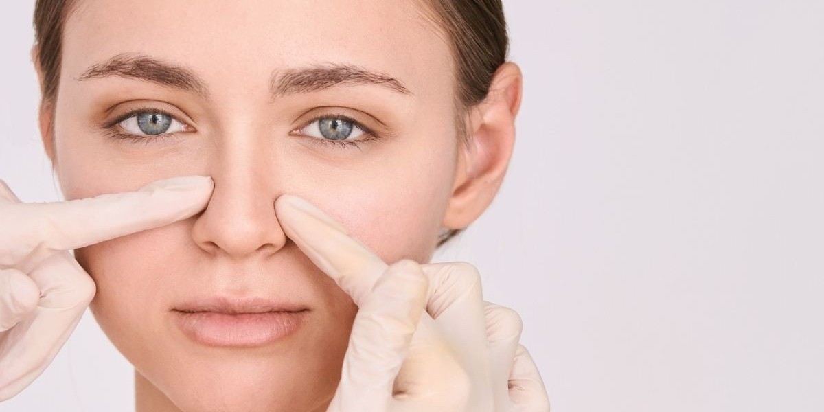 Choosing Alarplasty in Riyadh: Tips for Optimal Results