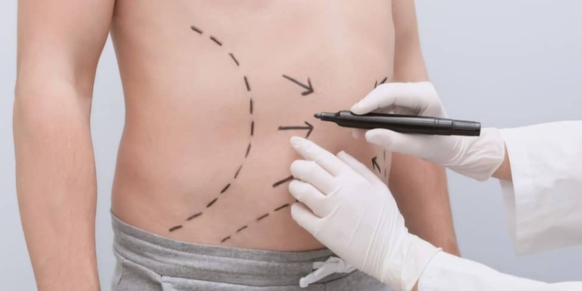 Combining Liposuction with Other Body Contouring in Riyadh