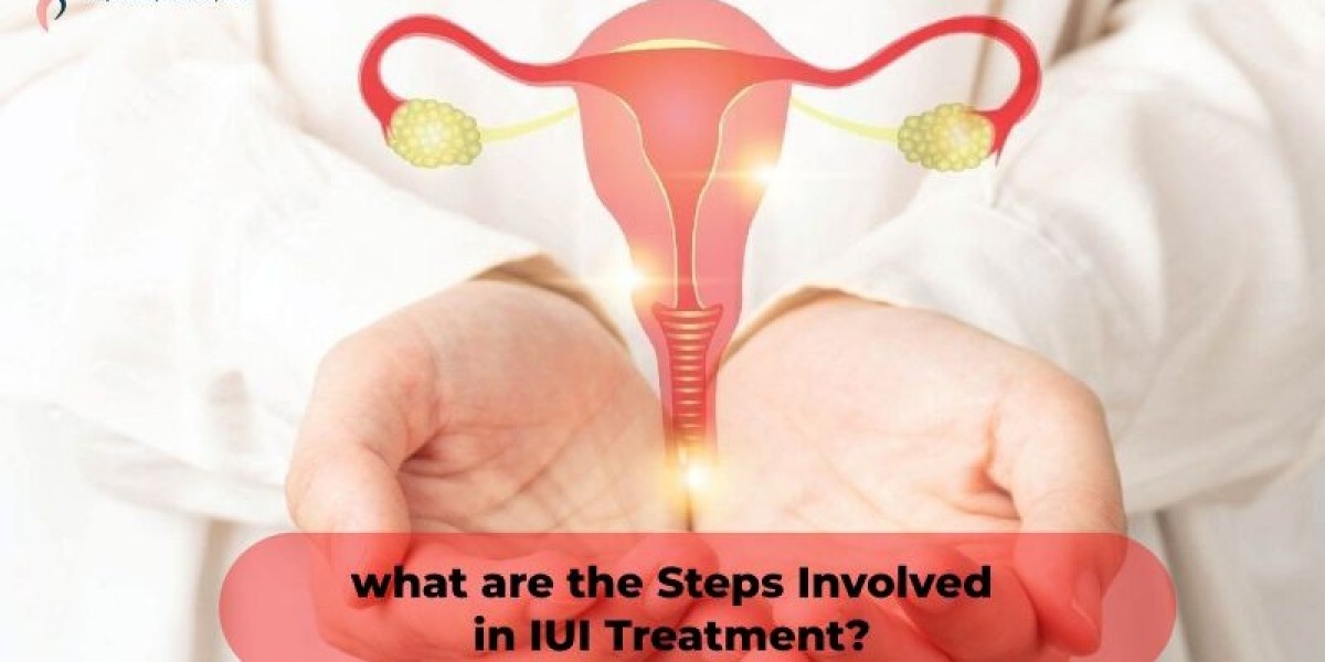 Understanding the Steps Involved in IUI Treatment