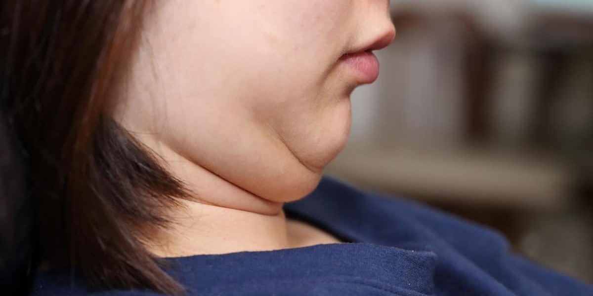 Targeted Double Chin Treatments in Riyadh for a Refined Look