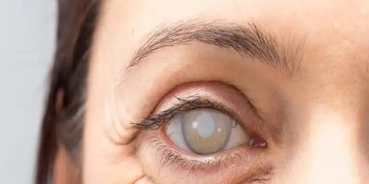 Do’s And Don’ts Before Cataract Surgery
