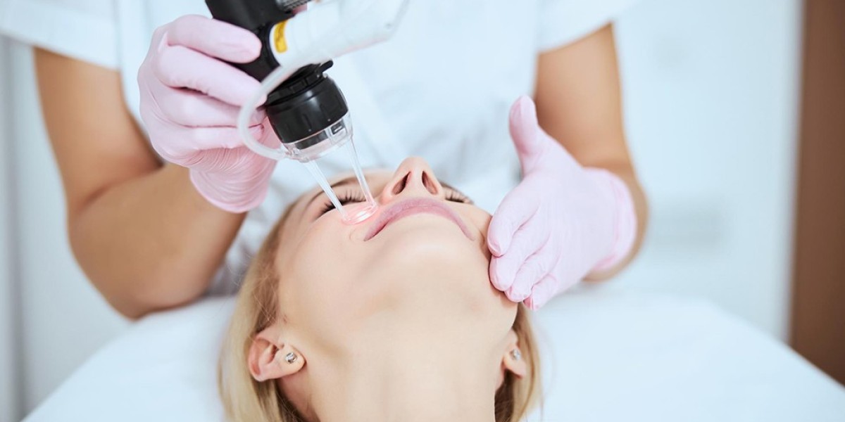 A Complete Overview of Fractional CO2 Laser Treatments