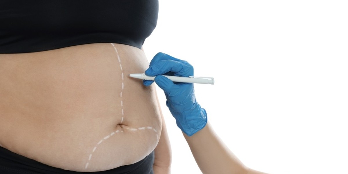 How Painful is Bariatric Surgery? Understanding Pain and Recovery
