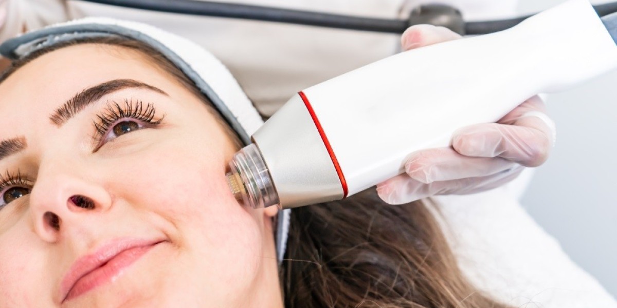 A Closer Look at Fractional RF Microneedling for Skin Repair