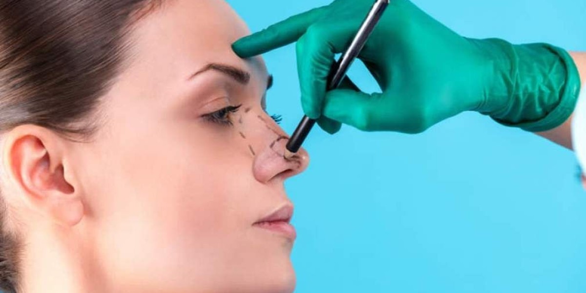 Surgical vs. Non-Surgical Rhinoplasty: What Riyadh Experts Say