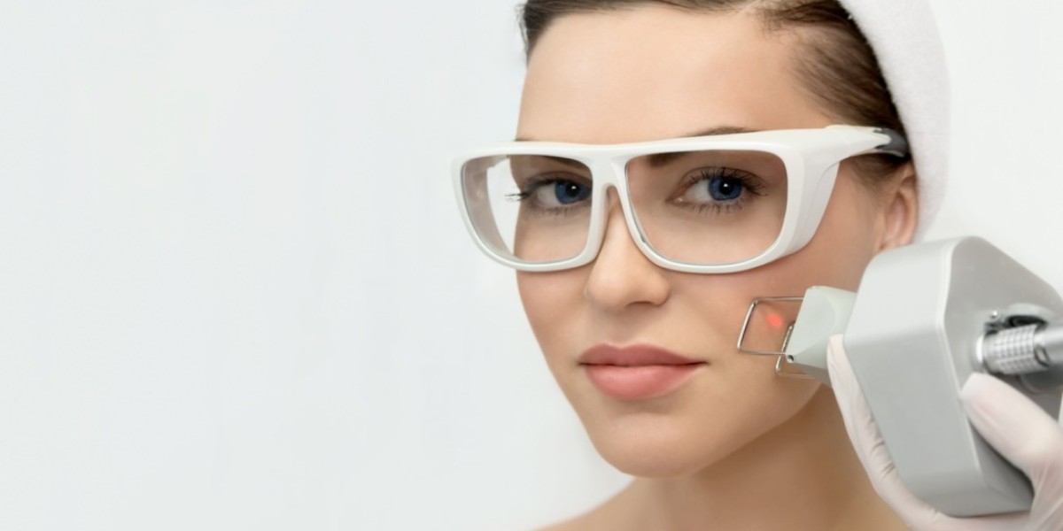 How Laser Technology is Used for Birthmark Removal in Riyadh