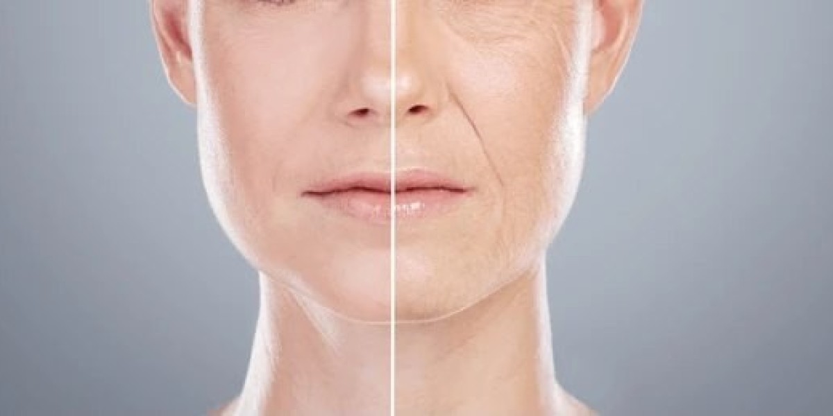 Facelift vs. Non-Surgical Alternatives: Which One is Right for You?