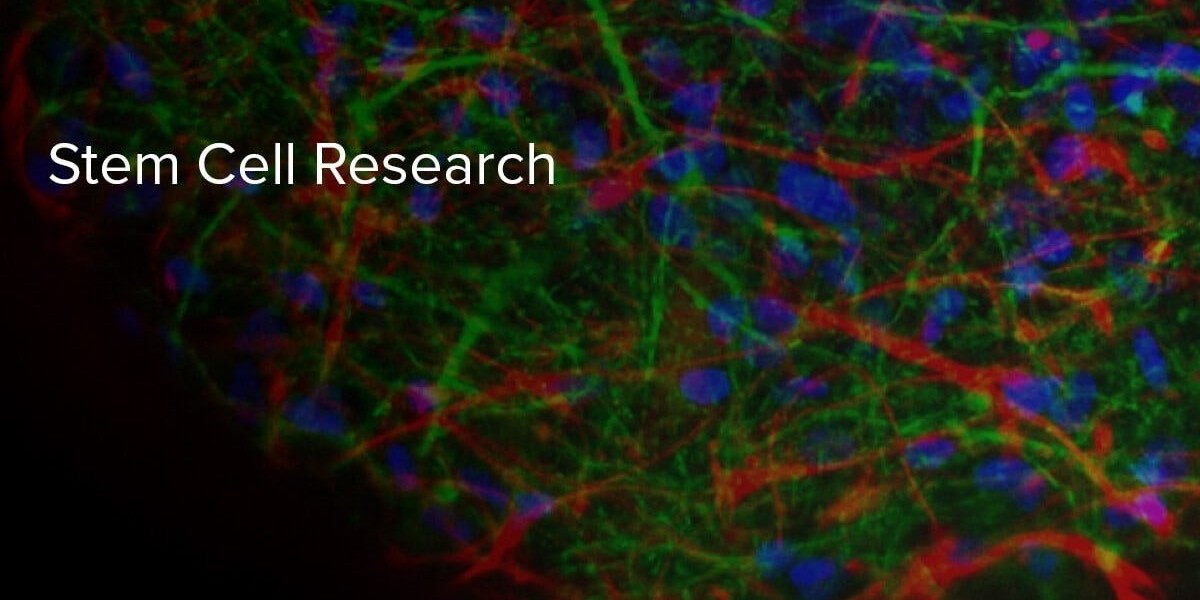 Europe Stem Cell Assay Market Size, Share, Growth, Trends 2032