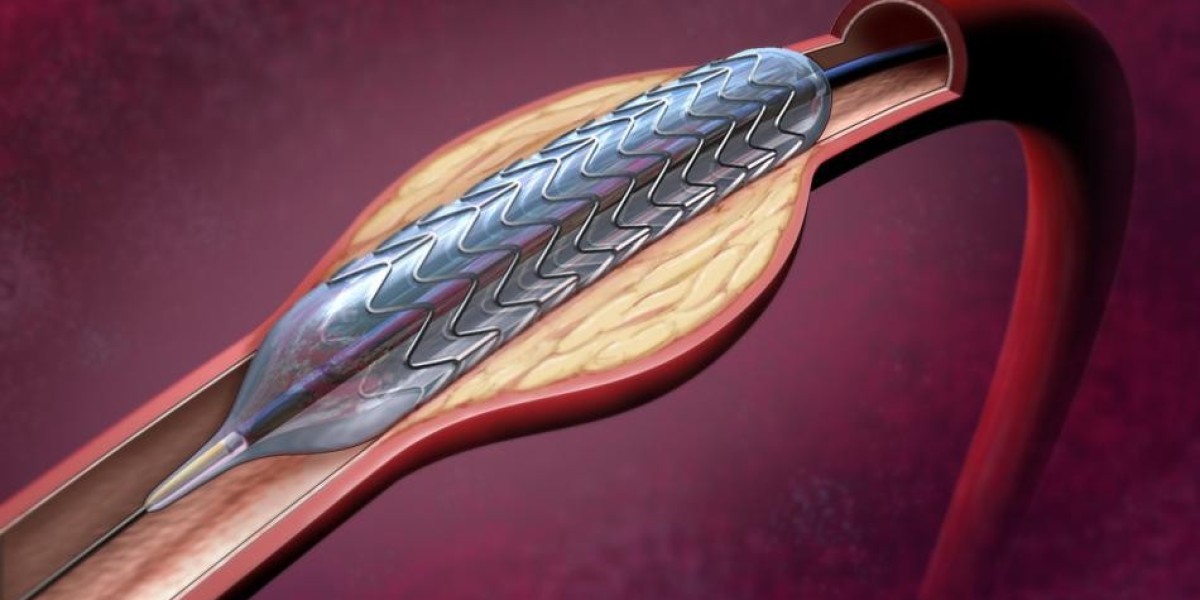 Global Lung Stent Market is Estimated to Witness Growth Owing to Growing Prevalence of Lung Cancer