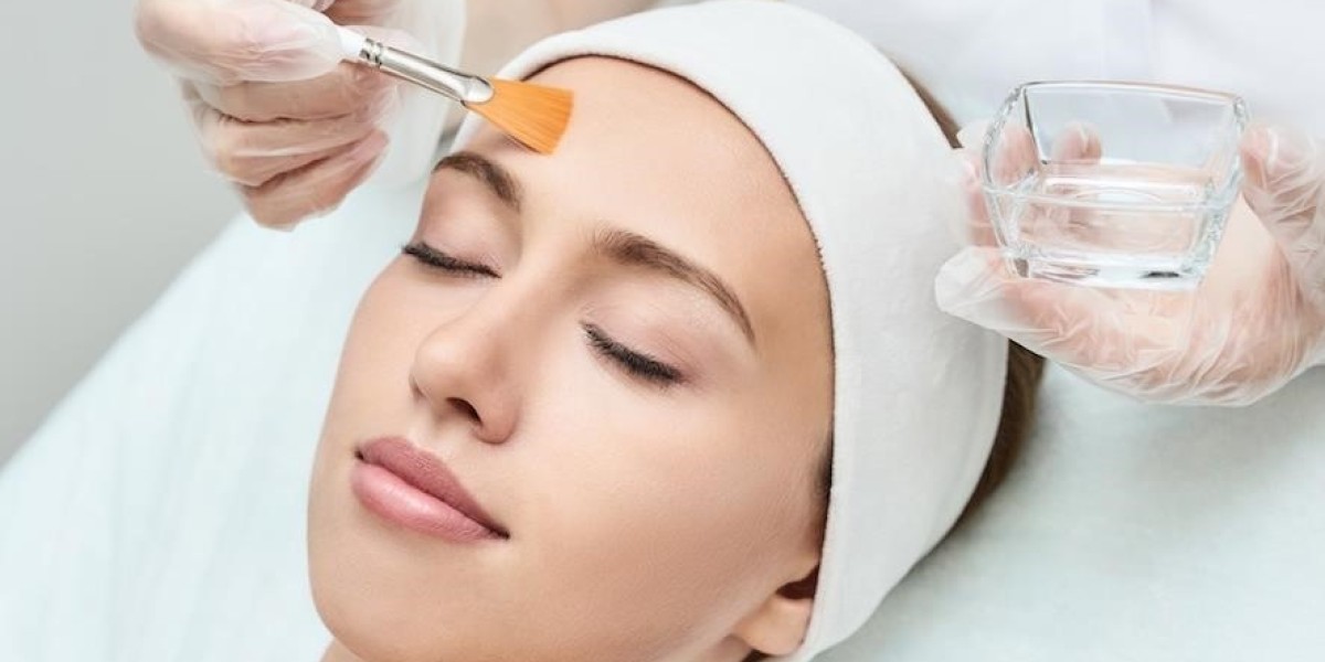 Chemical Peels for Aging Skin: Rejuvenate Your Look in Dubai