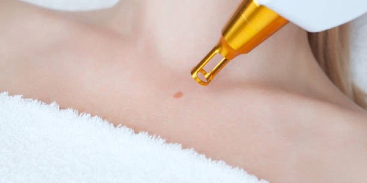 Debunking Myths About Cryosurgery – Cryotherapy in Riyadh