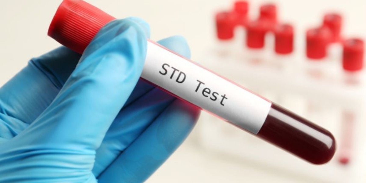 How to Prepare for Your First STD Test: A Step-by-Step Guide