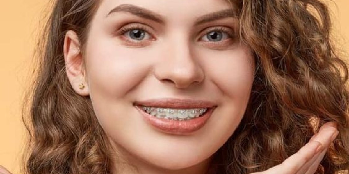 Metal Braces in Riyadh: A Reliable Solution for Your Orthodontic Issues
