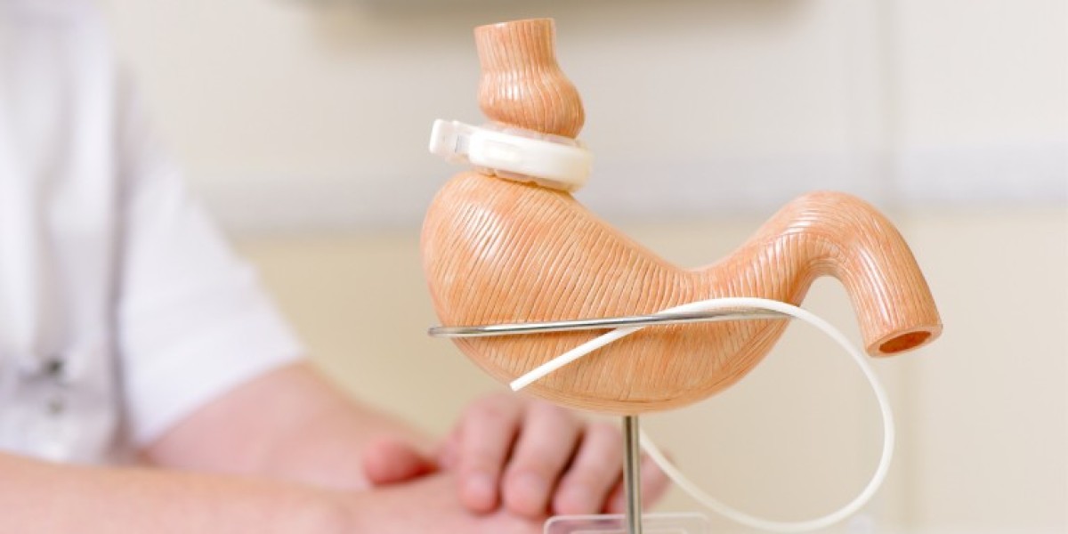 Understanding Bariatric Surgery's Impact on Dubai's Health Services
