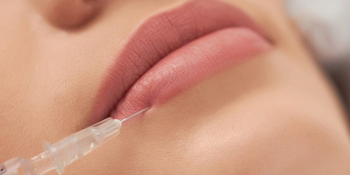 Lip Filler Trends: Russian Lip Fillers in Riyadh Explained