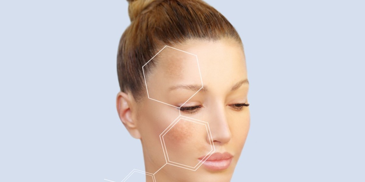 Experience the Benefits of Fractional RF Microneedling for Skin Tightening in Dubai