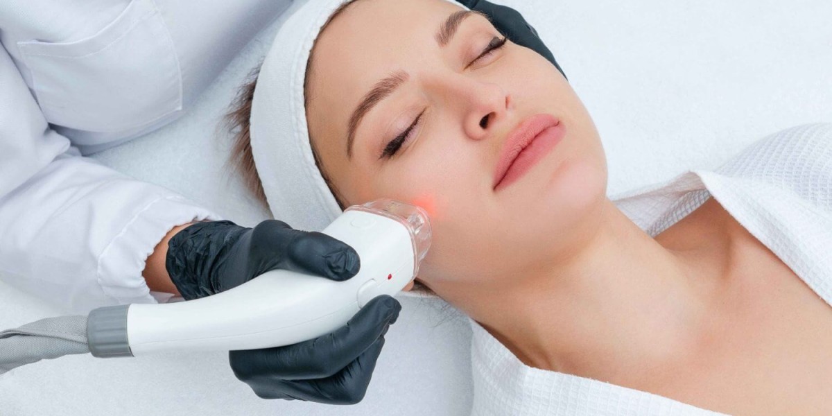 Understanding the Cost of Laser Treatments in Riyadh