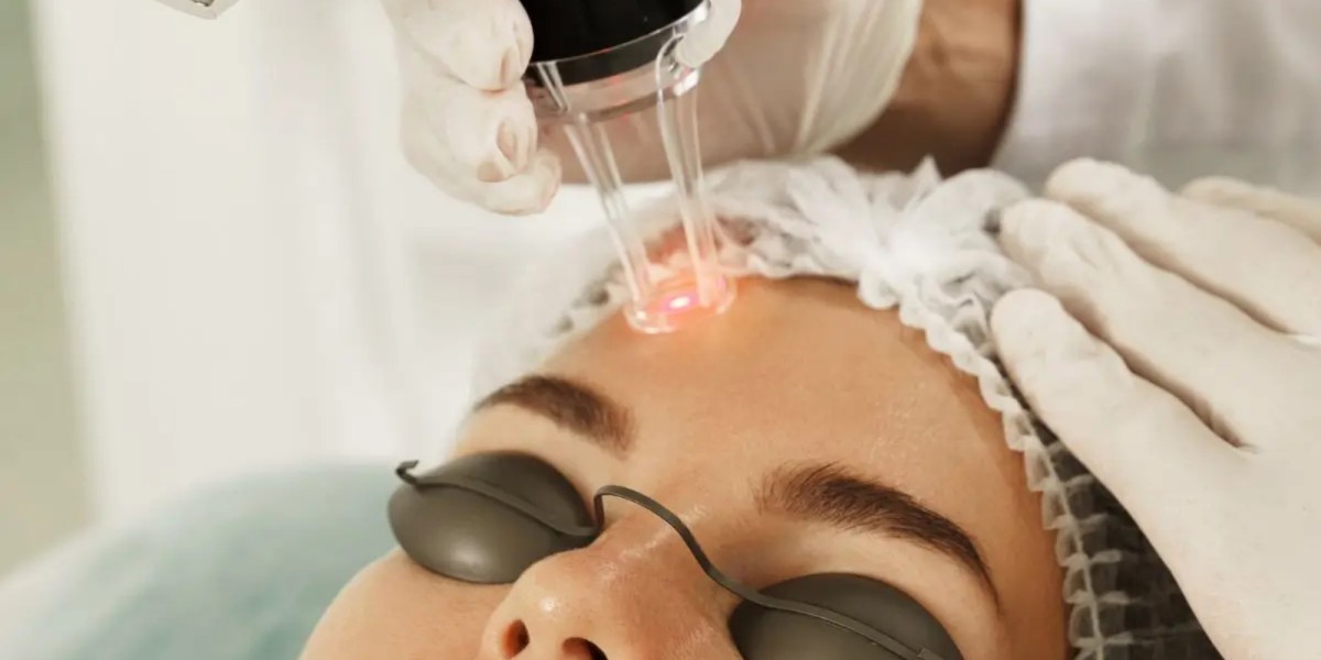 Evaluating the Overall Cost of Fractional CO2 Laser Treatments