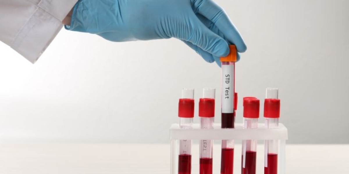 The Advantages of Same Day STD Testing in London