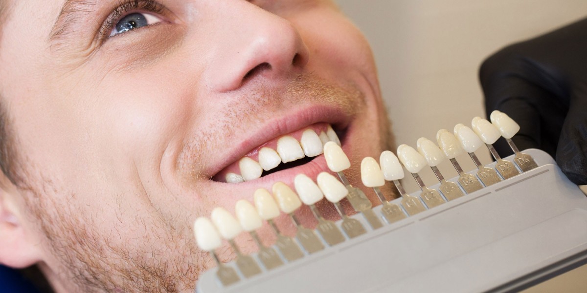Innovative Dental Veneers and Laser Treatments for Your Smile
