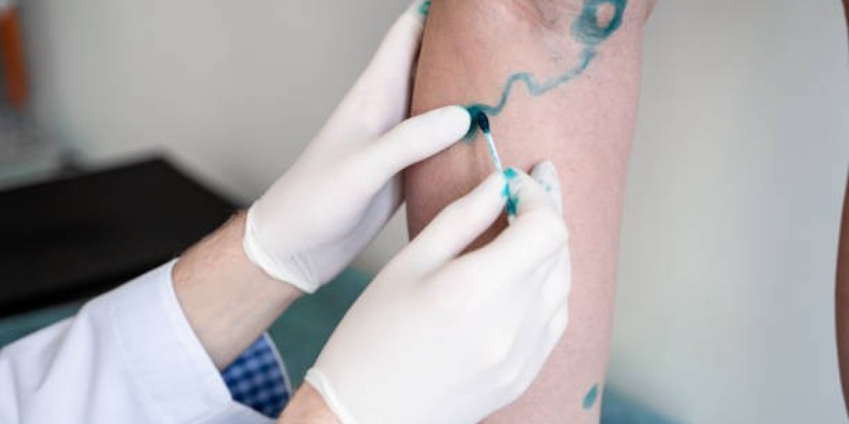 How Vascular Surgery in Riyadh Can Improve Your Quality of Life
