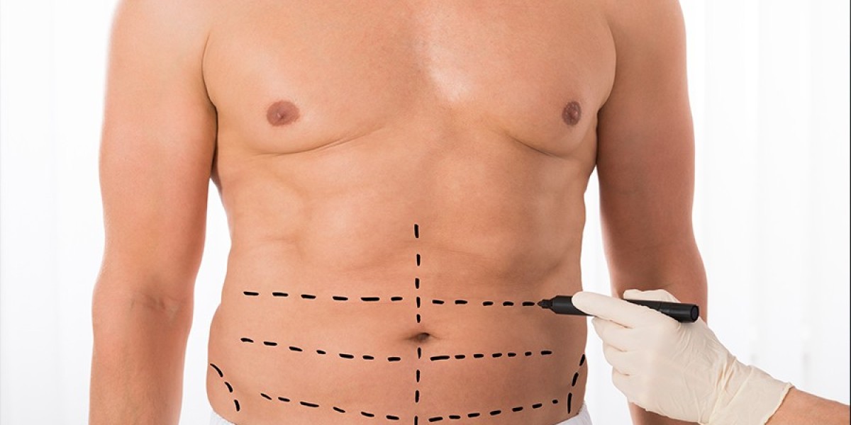 VASER Liposuction in Riyadh: Advanced Fat Removal Technology