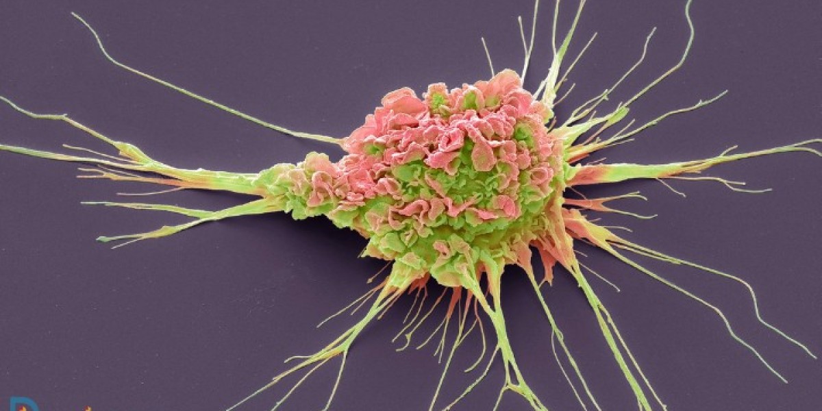 Navigating the HR-positive/HER2-negative Breast Cancer Market: Emerging Drugs and Opportunities