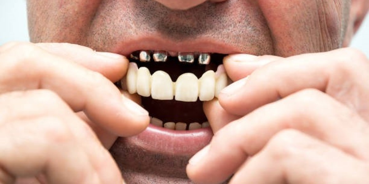 Dental Bridge in Riyadh: Your Solution for Missing Teeth