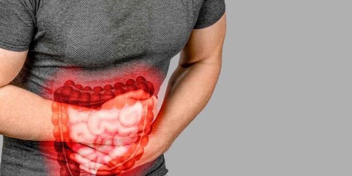 دليل المريض: علاج حصوات المرارة في الرياض خطوة بخطوة