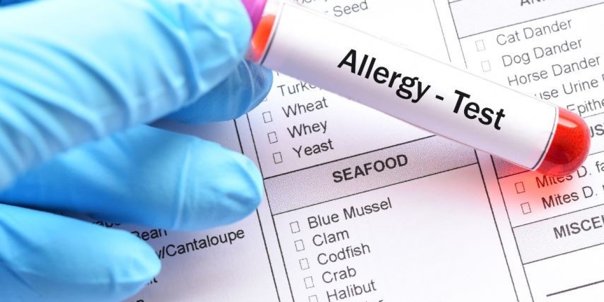How to Find Affordable Allergy Testing in London