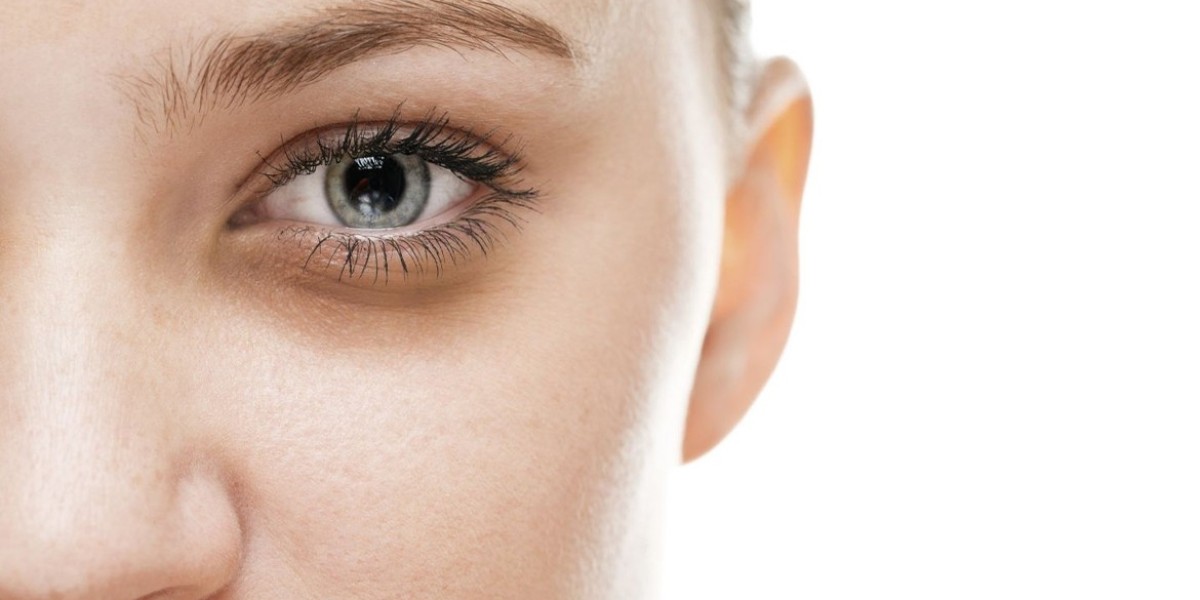 Natural Dark Circles Treatment Solutions Offered in Riyadh