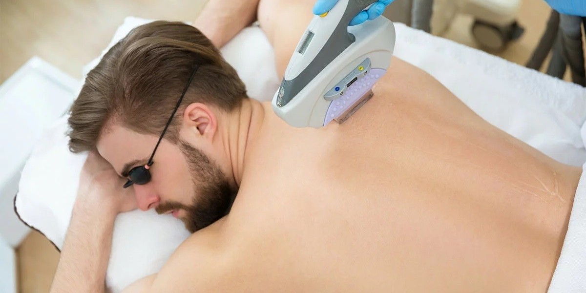 Do You Leave a Tip After Laser Hair Removal?